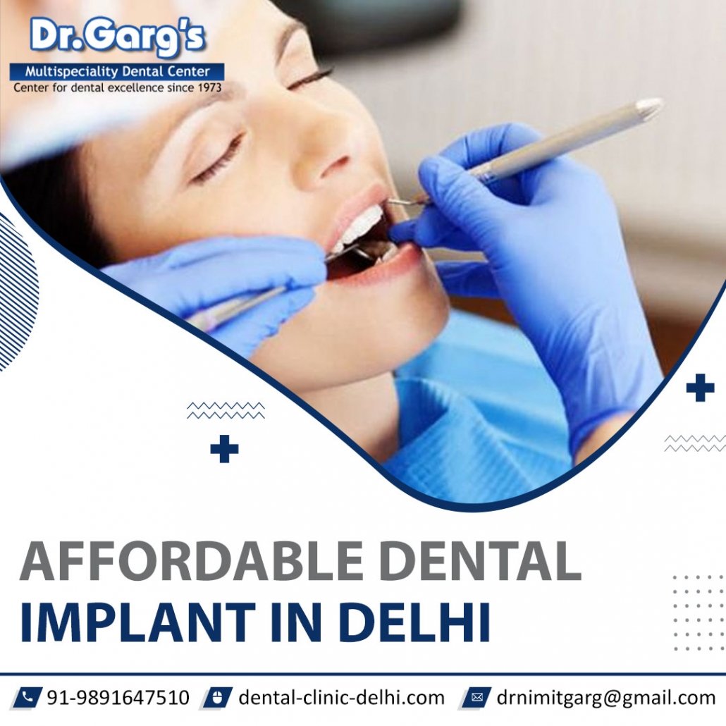 affordable dental implants in Delhi 1030x1030 - 3 Factors to Choose Affordable Dental Implants in Delhi