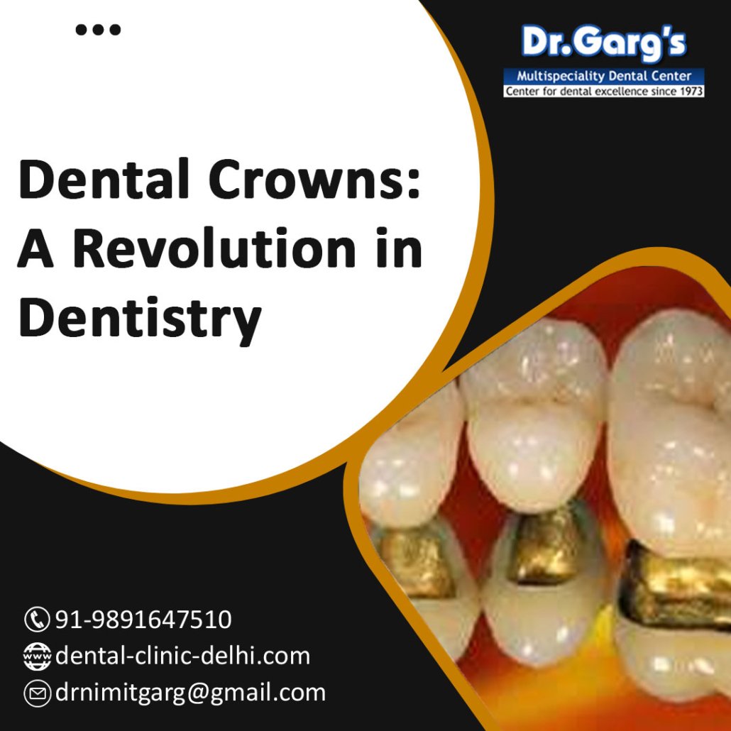 dental crowns a revolution in dentistry 1030x1030 - Dental Crowns: A Revolution in Dentistry